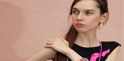 减肥得厌食症的女明星,女明星的痛苦挣扎